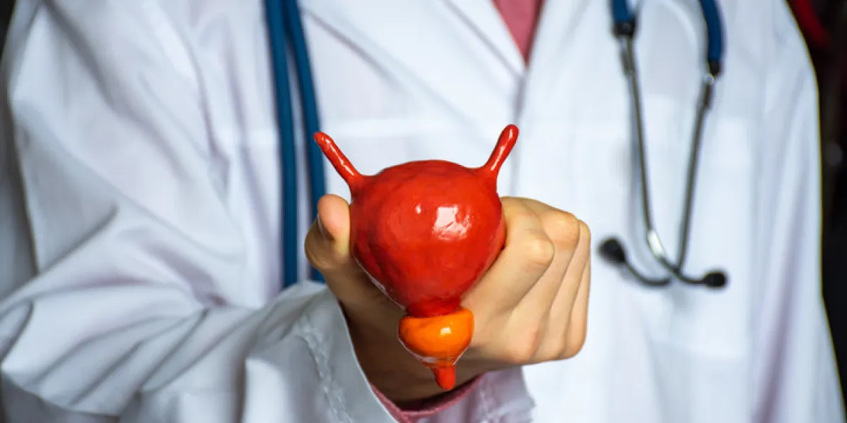 concept photo of study or diagnosis in urology doctor in white holds in his hand model of human urinary bladder with prostate, showing patient looks like the organ itself and its normal anatomy