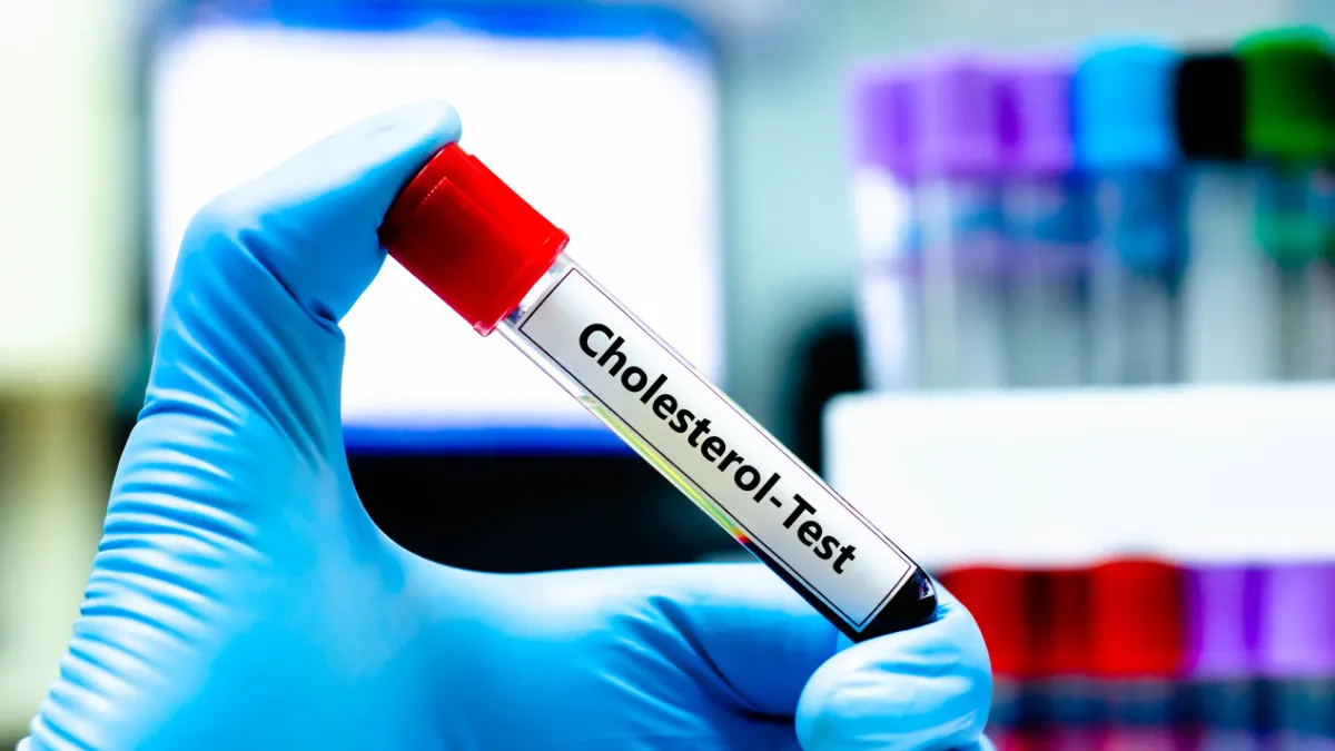 cholestérol