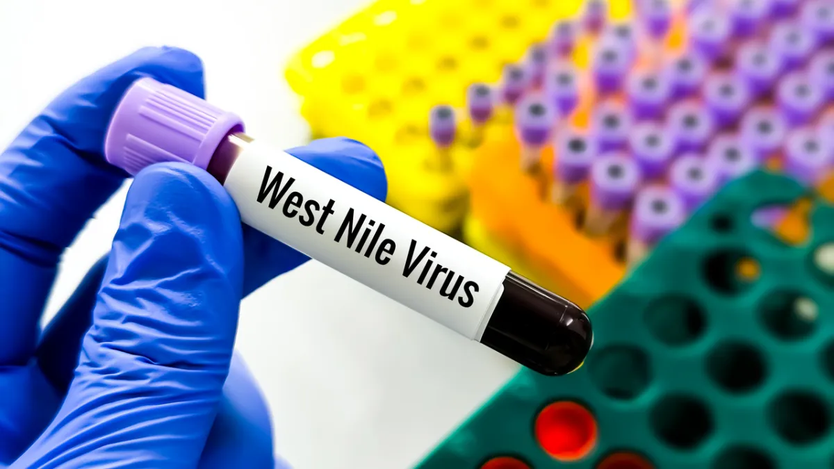 virus