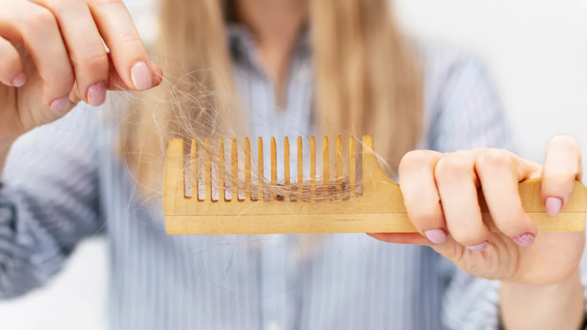perte cheveux 