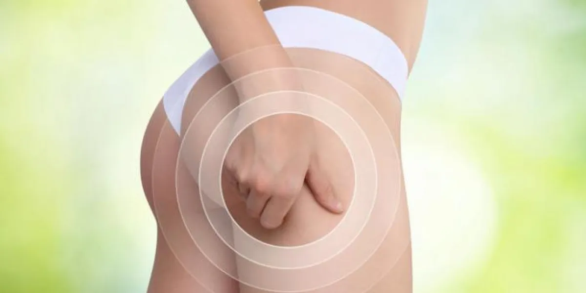 femme pince sa cuisse pour contrôler la cellulite