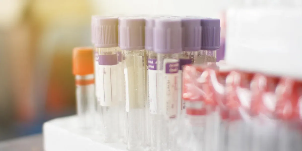 hematology blood analysis report with lavender color sample collection tubesblood tubes with labels for proper identification and background hand of laboratory technician