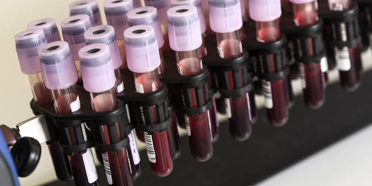 tube blood sample in a medical examination medical research