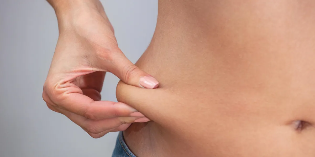 girl pulls hand the skin on the abdomen, showing the body fat in the abdominal area and sides treatment and disposal of excess weight, the deposition of subcutaneous fat girl pulls hand the skin on the abdomen, showing the body fat in the abdominal area and sides treatment and disposal of excess weight, the deposition of subcutaneous fat
