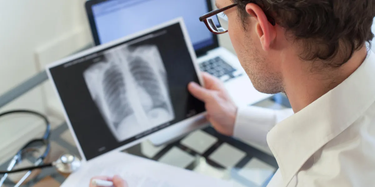 docteur, vérification, rayons x, poumons, écriture, diagnostic, clinique docteur, vérification, rayons x, poumons, écriture, diagnostic, clinique