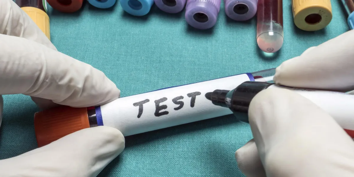 vial to blood sampling, drug control laboratory, conceptual image vial to blood sampling, drug control laboratory, conceptual image