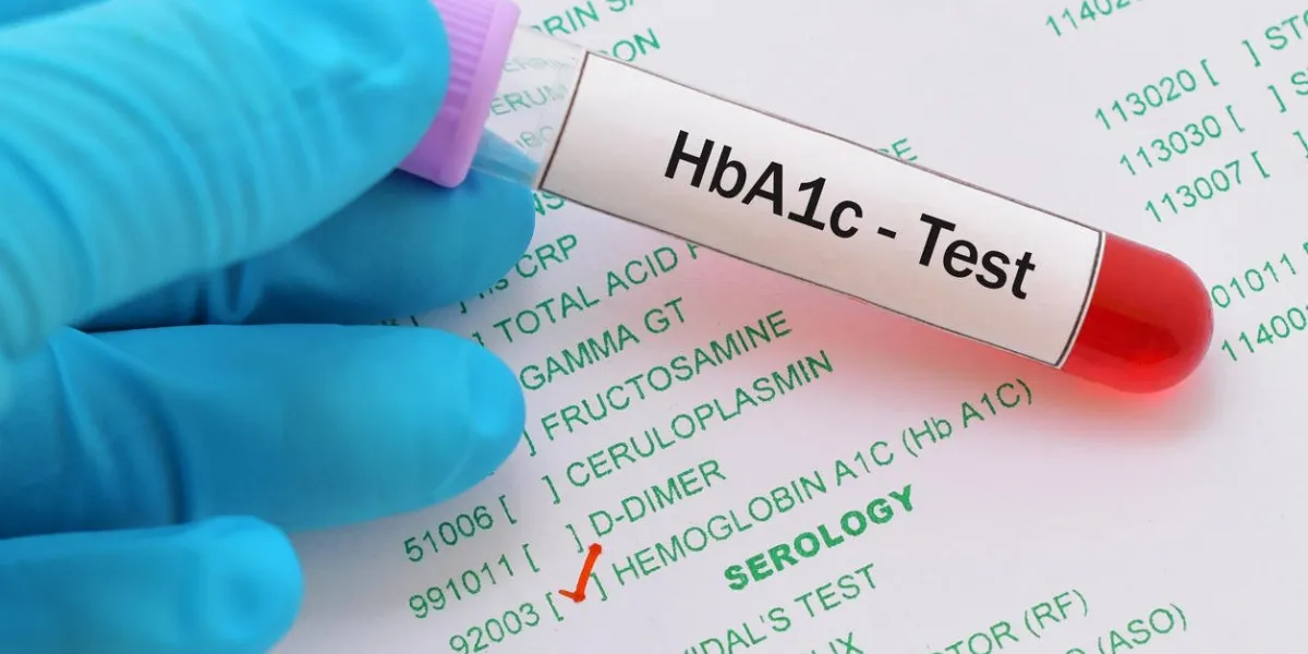 blood sample with requisition form for hba1c test, diagnosis for diabetes