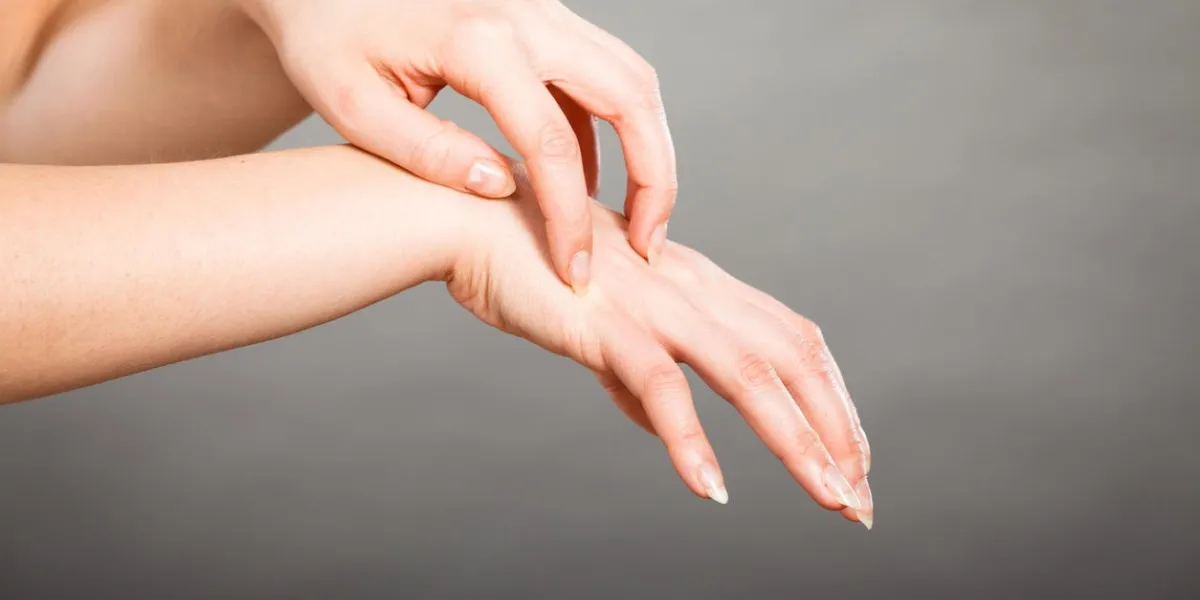 dermatology, allergy and health problem young female scratching her itchy palm with allergy rash dermatology, allergy and health problem young female scratching her itchy palm with allergy rash