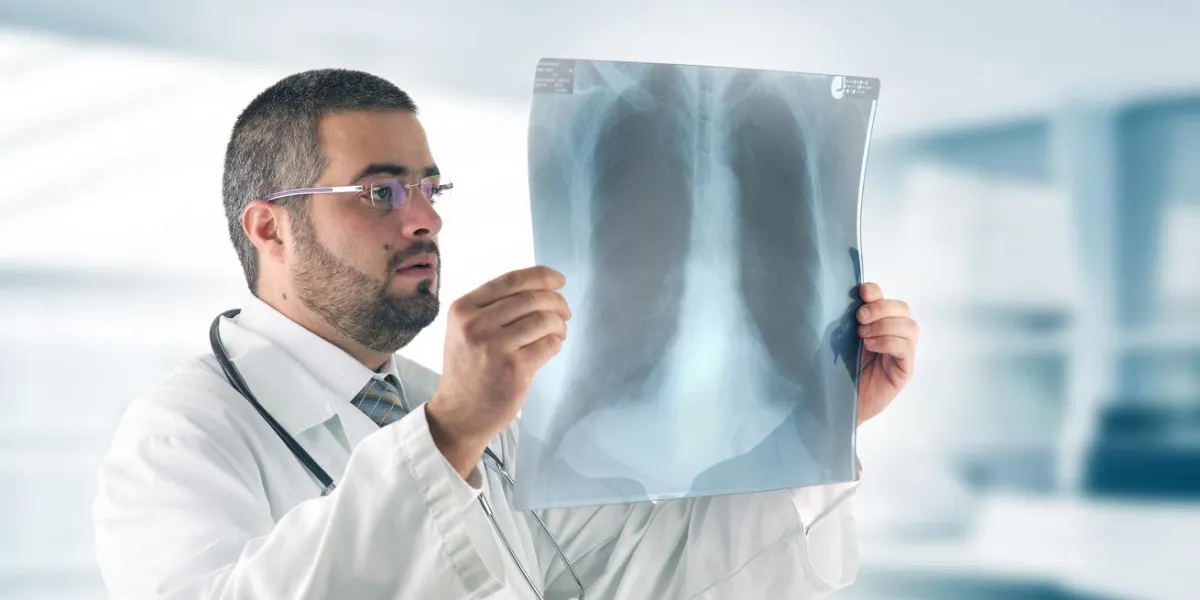 doctor examining an x-ray image doctor examining an x-ray image
