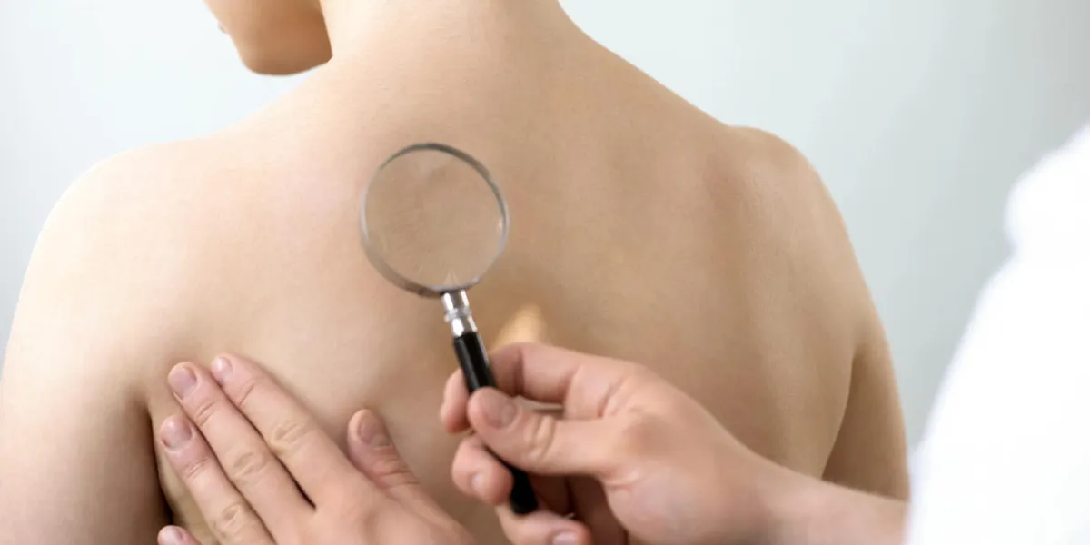 dermatologist examining ladys skin through magnifying glass, cancer prevention