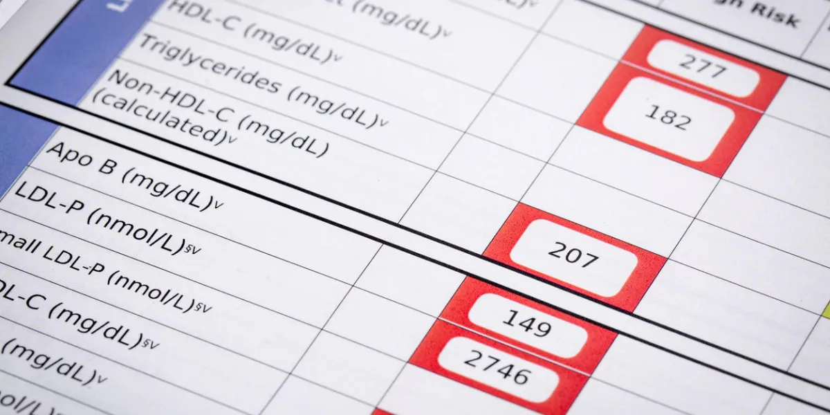 red flags for high risk cholesterol - a detail of blood laboratory screening results with focus on lipids panel red flags for high risk cholesterol - a detail of blood laboratory screening results with focus on lipids panel