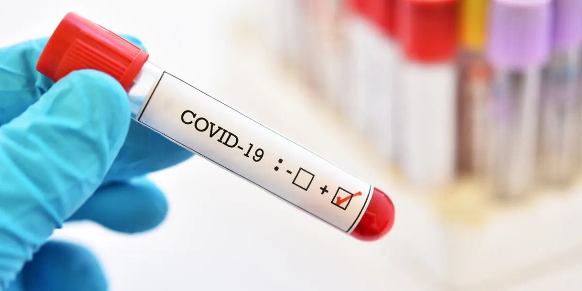 blood sample tube positive with covid-19 or novel coronavirus 2019 found in wuhan, china blood sample tube positive with covid-19 or novel coronavirus 2019 found in wuhan, china