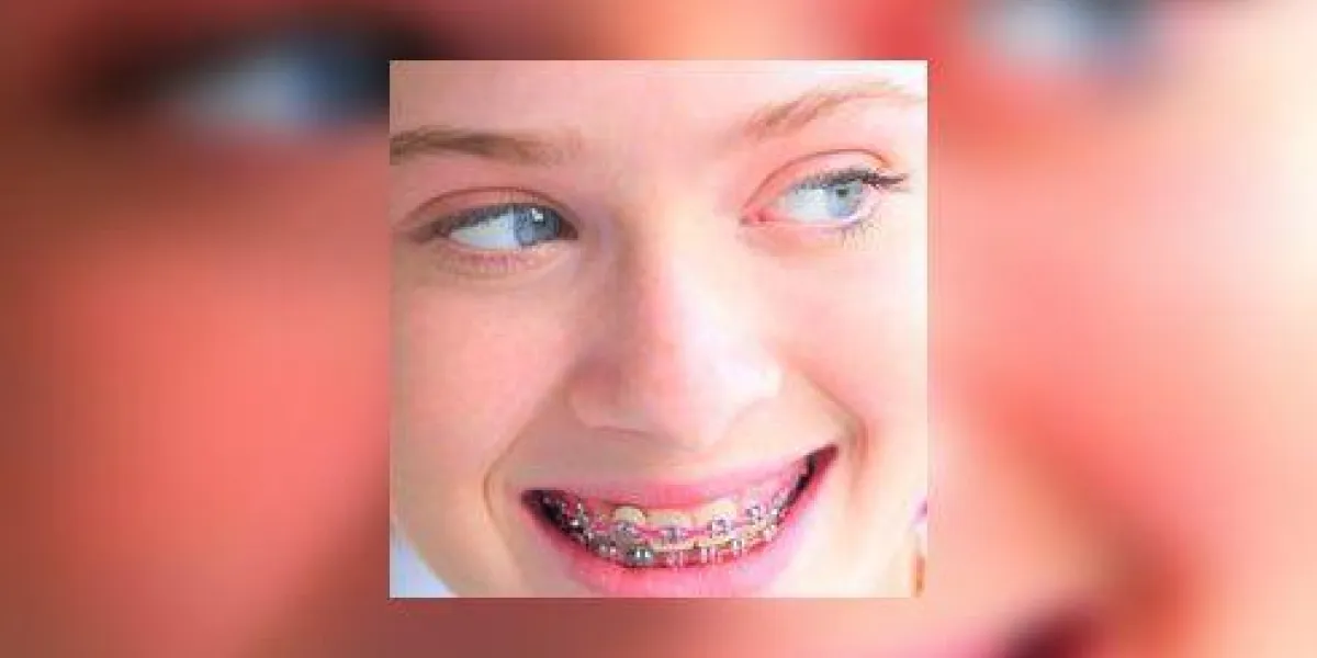 gros plan du visage d'une adolescente en souriant et en montrant ses accolades alors qu'elle regarde sur le côté
