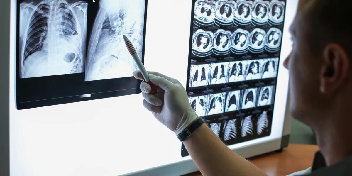 carrying out a description of the radiographs of a patient with copd carrying out a description of the radiographs of a patient with copd
