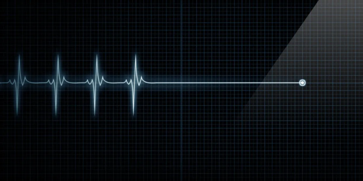 pouls horizontal trace moniteur cardiaque à la mort