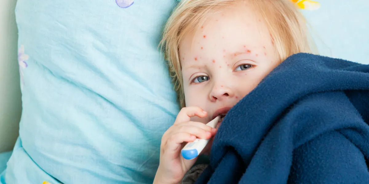 a sick girl with red spots in bed with a thermometer