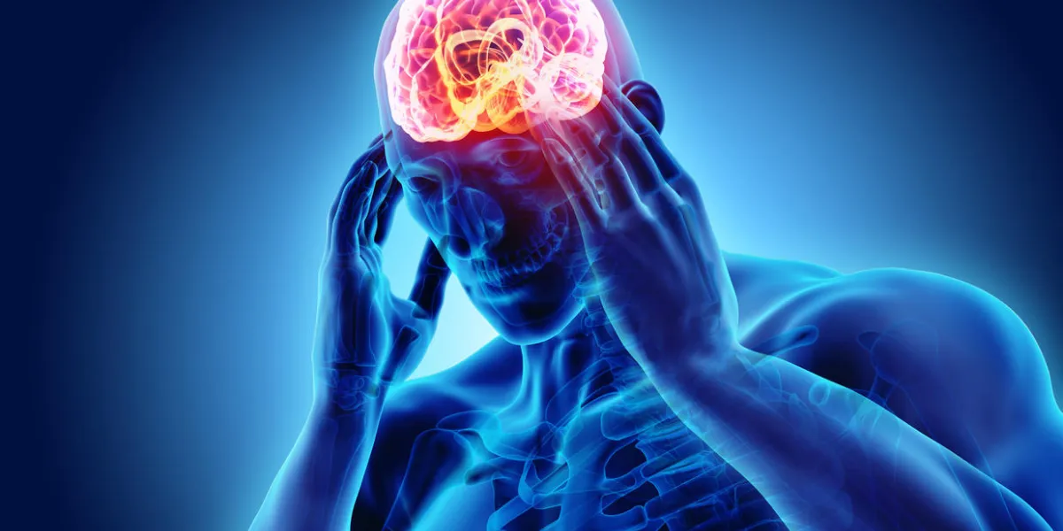 3d illustration of headache human, x-ray medical concept