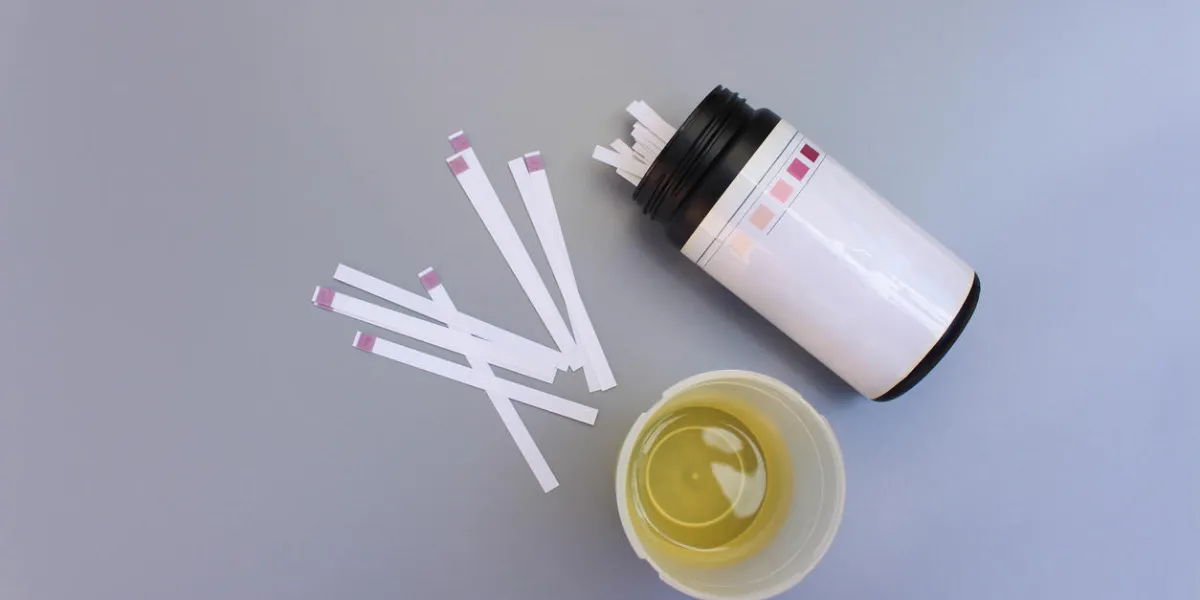 urine test strips on a gray background