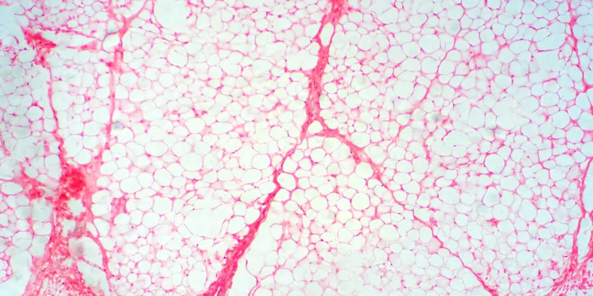 human fat body tissue under microscope view for physiology education human fat body tissue under microscope view for physiology education