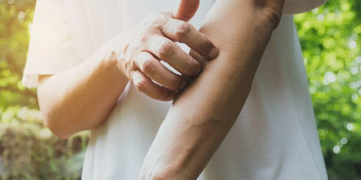 man scratch itch with hand man scratching his arm healthcare concept man scratch itch with hand man scratching his arm healthcare concept