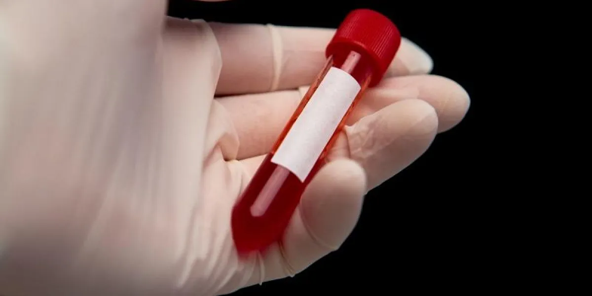 gloved hand holding vial of blood on black background gloved hand holding vial of blood on black background