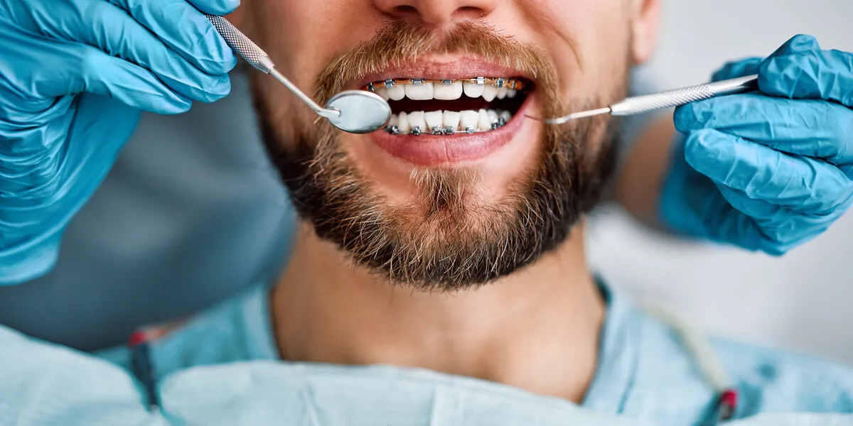 cropped portrait of handsome man with braces sitting in dental chair doctor in gloves holding examination tools behind braces, alignment of teeth