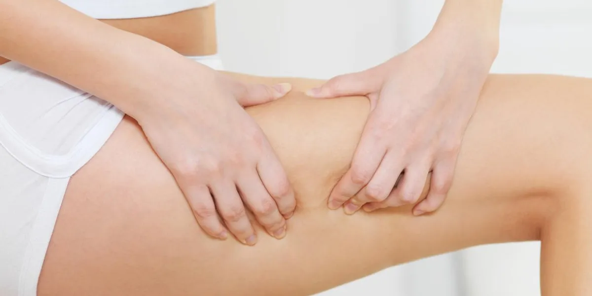 female squeezes cellulite skin on her legs - close-up fragment