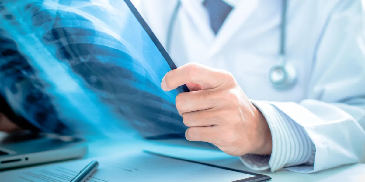 close up of male doctor holding x-ray or roentgen image close up of male doctor holding x-ray or roentgen image
