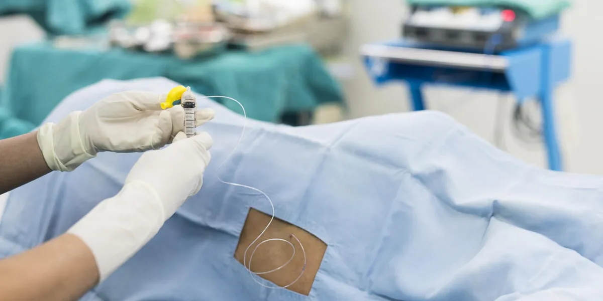 epidural nerve block epidural nerve block