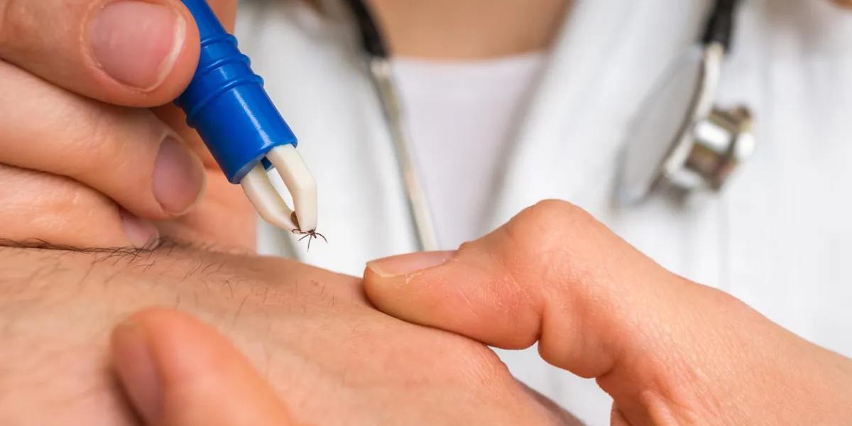 female doctor removing a tick with tweezers from hand of patient encephalitis, borreliosis and lyme disease female doctor removing a tick with tweezers from hand of patient encephalitis, borreliosis and lyme disease