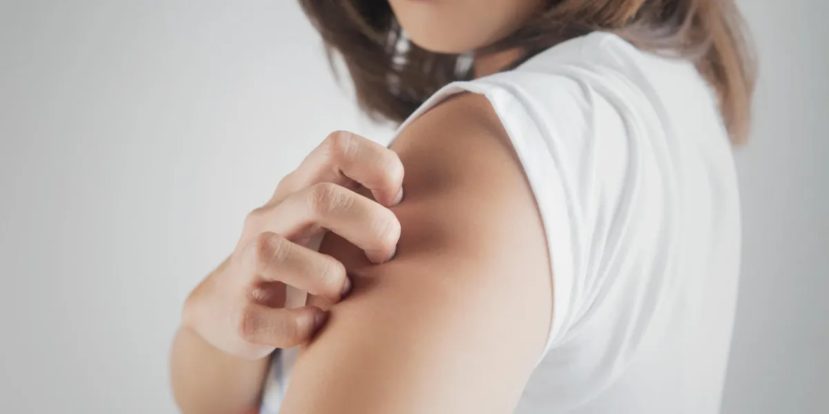 woman scratching her arm