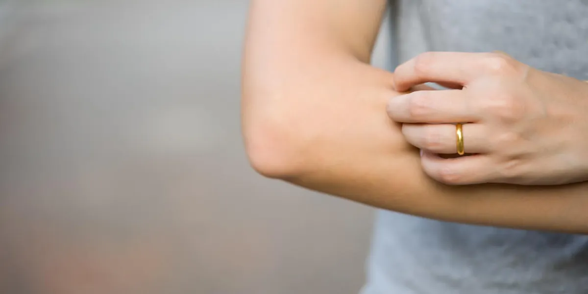 health problem closeup asian girl scratching her itchy arm health problem closeup asian girl scratching her itchy arm