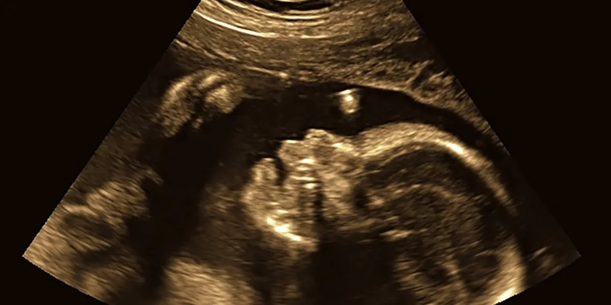 ultrasound of baby in pregnant woman in dark background ultrasound of baby in pregnant woman in dark background