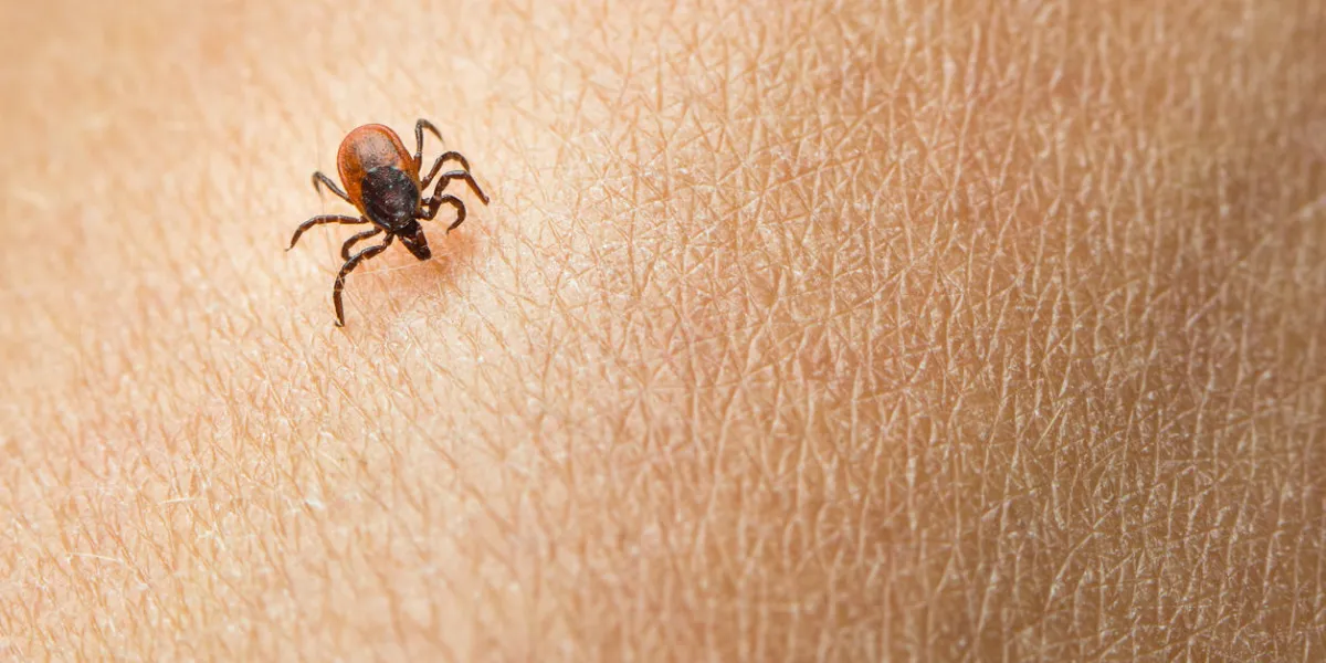 tick - parasitic arachnid blood-sucking carrier of various diseases on a human skin tick - parasitic arachnid blood-sucking carrier of various diseases on a human skin