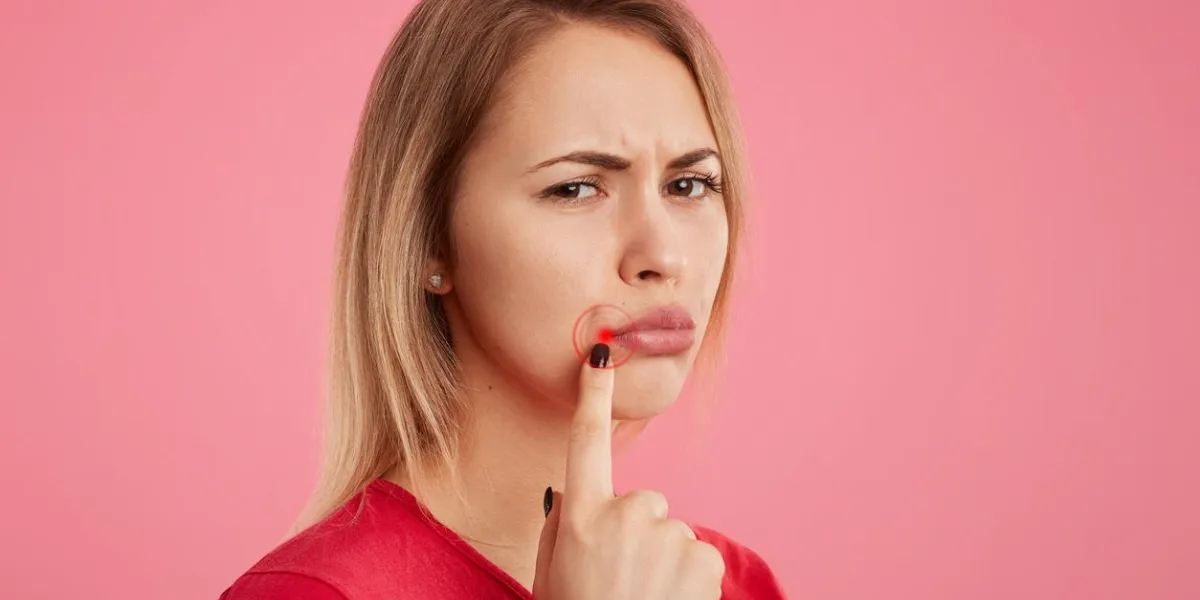 discontent young beautiful female with unhappy look, has oral herpes, indicates at wound near lips, stands sideways against pink background people, skin care and health problems concept