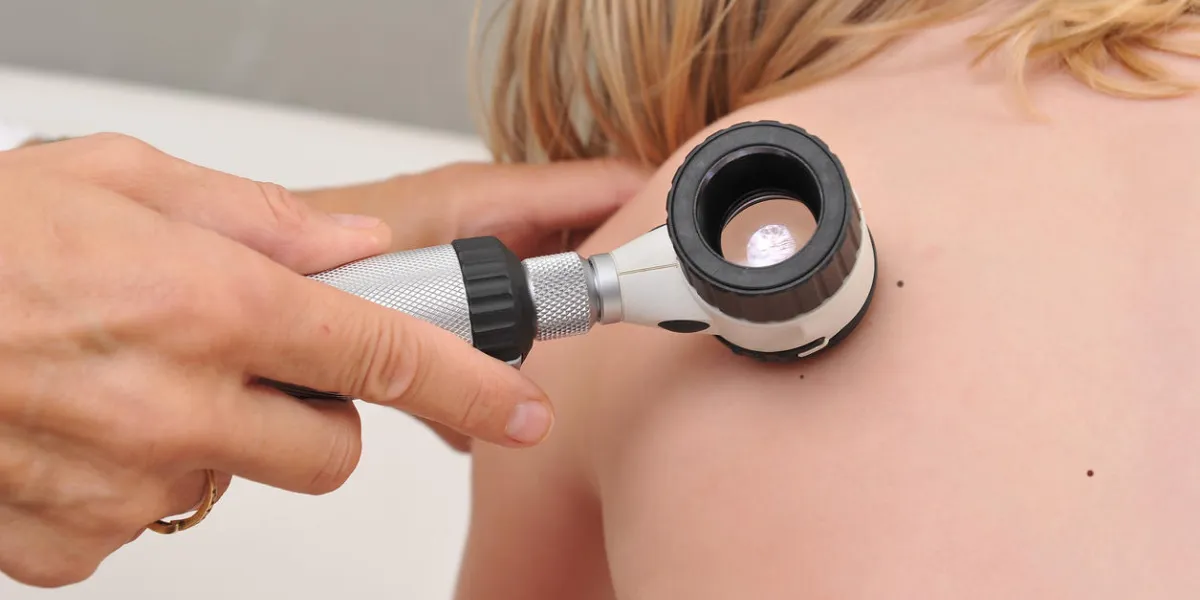 dermatologist examines child patient birthmark with dermatoscope mole checkup professional dermoscopy dermatologist examines child patient birthmark with dermatoscope mole checkup professional dermoscopy