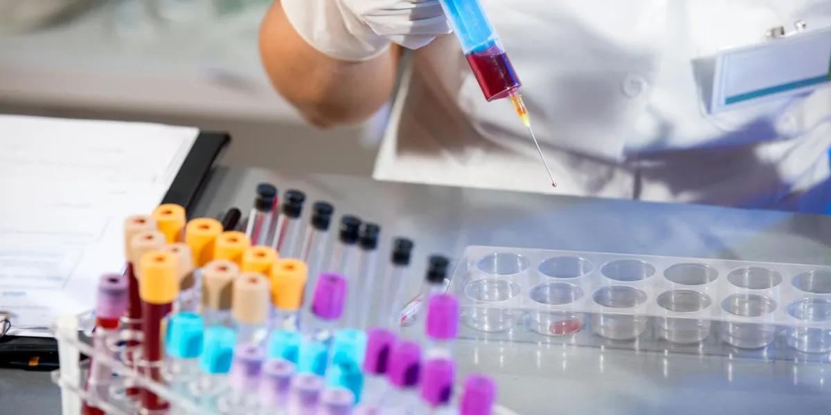 scientist working with blood samples in laboratory scientist working with blood samples in laboratory