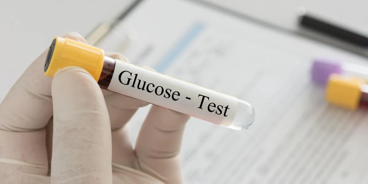 doctor holding sample blood collection tube with glucose test label in the lab