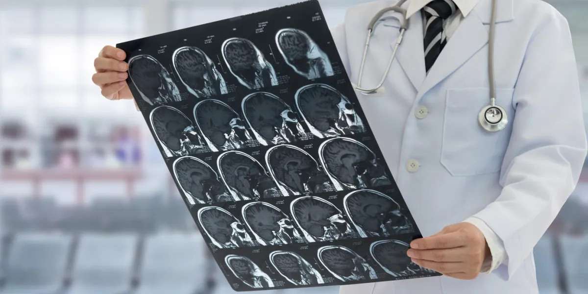 doctor examines film x-ray brain by mri or ct scan of the patient
