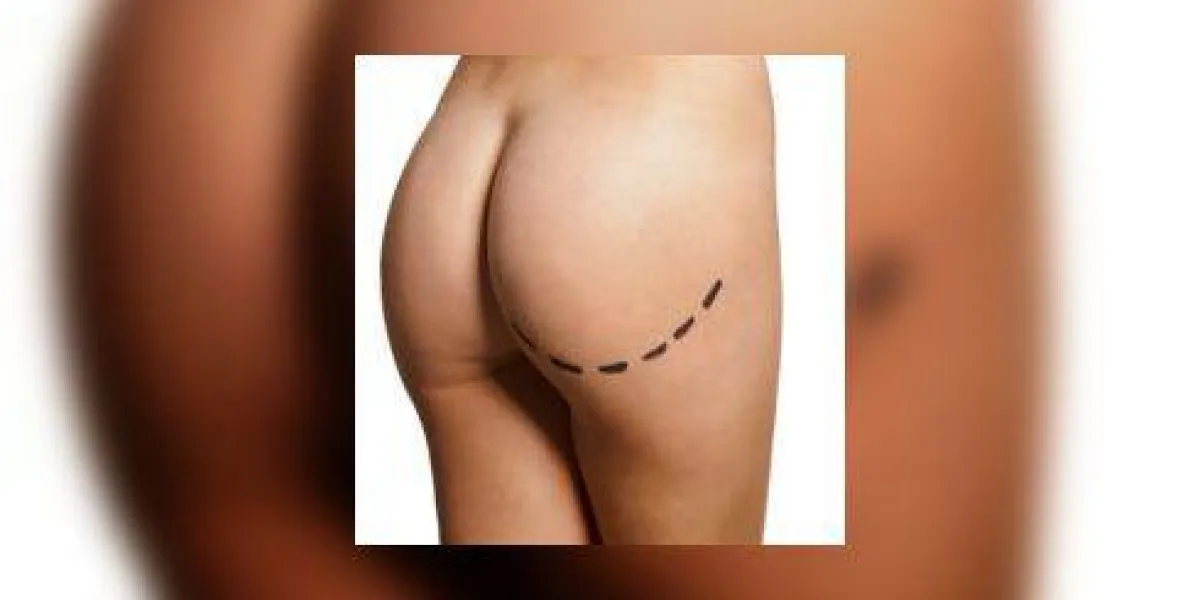ligne pointillée courbe marquée à travers le dos d'une femme