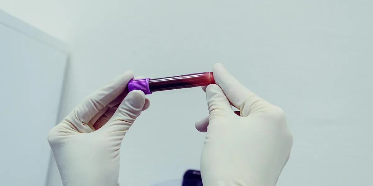biochemical lab picked up a tube of blood tests to check dopping, cholesterol, hiv