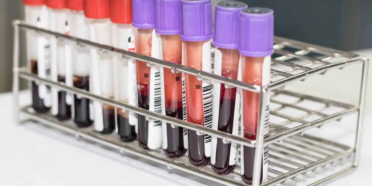 blood test tube