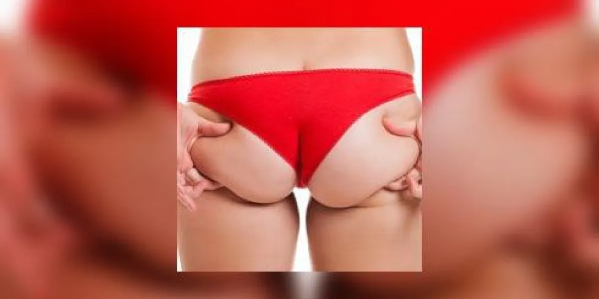 femme en surpoids tenant et en pinçant le fond du corps ou les fesses