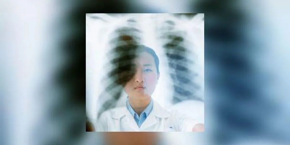gros plan, de, a, femme, médicale, professionnel, tenue, une, rayon x gros plan, de, a, femme, médicale, professionnel, tenue, une, rayon x