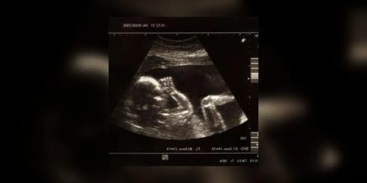 photo d'un bébé dans le ventre de sa mère photo d'un bébé dans le ventre de sa mère