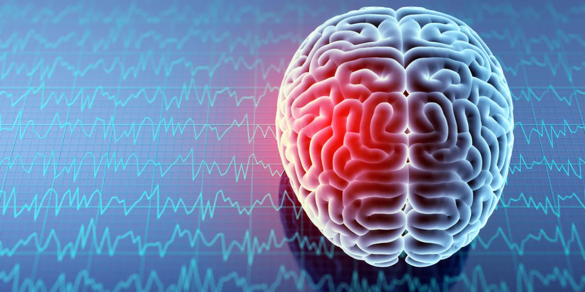 headache area on brain x-ray, 3d illustration