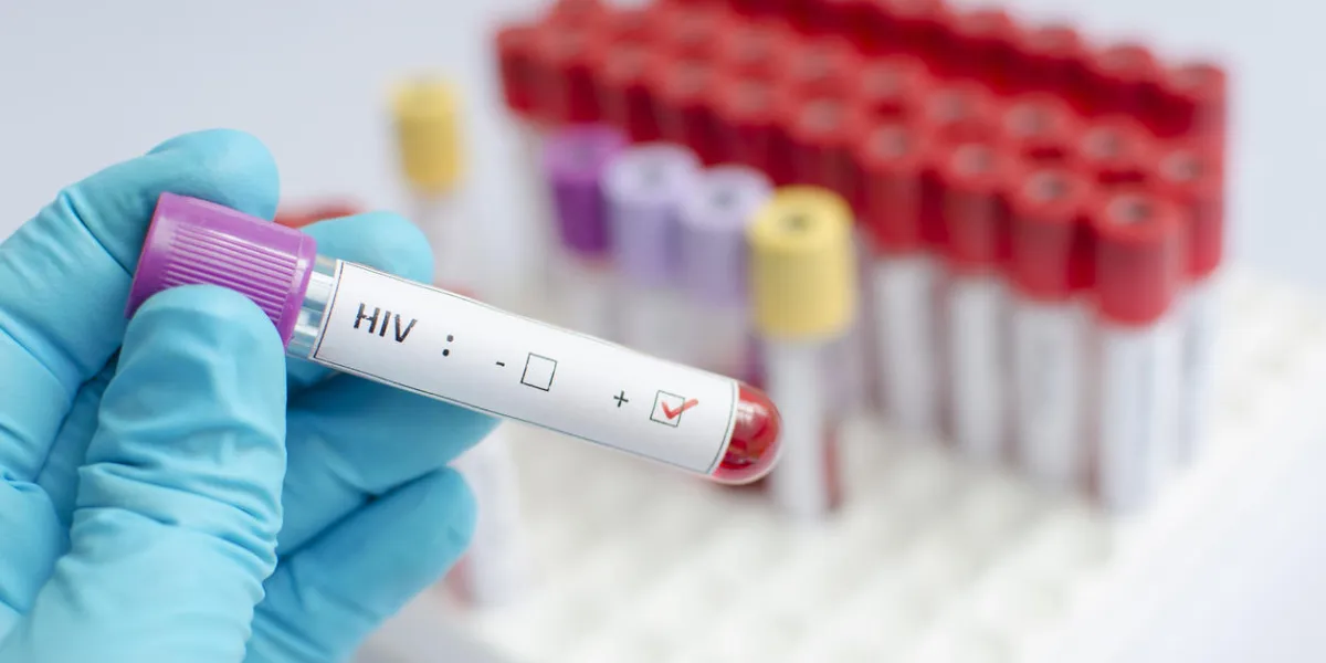 blood sample positive with hiv blood sample positive with hiv