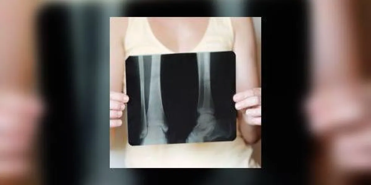 femme tenant une image radiographique femme tenant une image radiographique