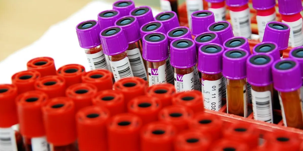 blood samples in blood bank blood samples in blood bank