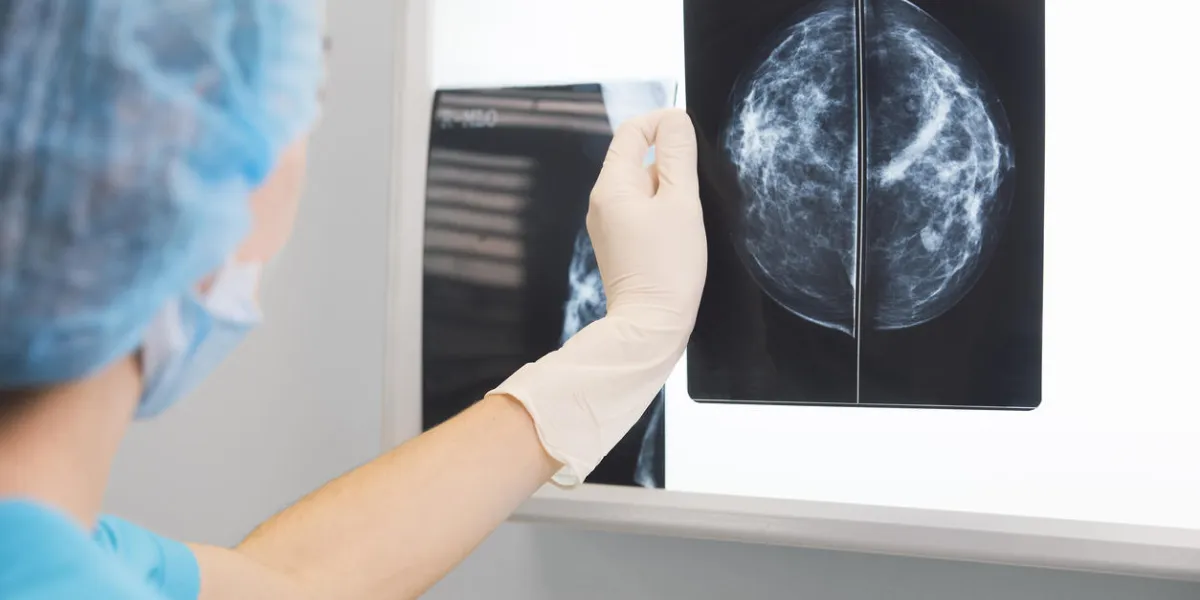 femme médecin ou infirmière en tenue de chirurgie tient une mammographie devant l'illuminateur à rayons x femme médecin ou infirmière en tenue de chirurgie tient une mammographie devant l'illuminateur à rayons x